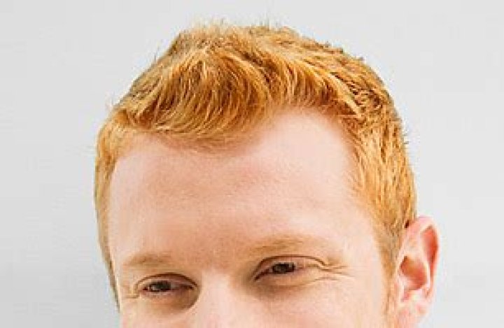 Is Sperm from Redheads Really Less Desirable?
