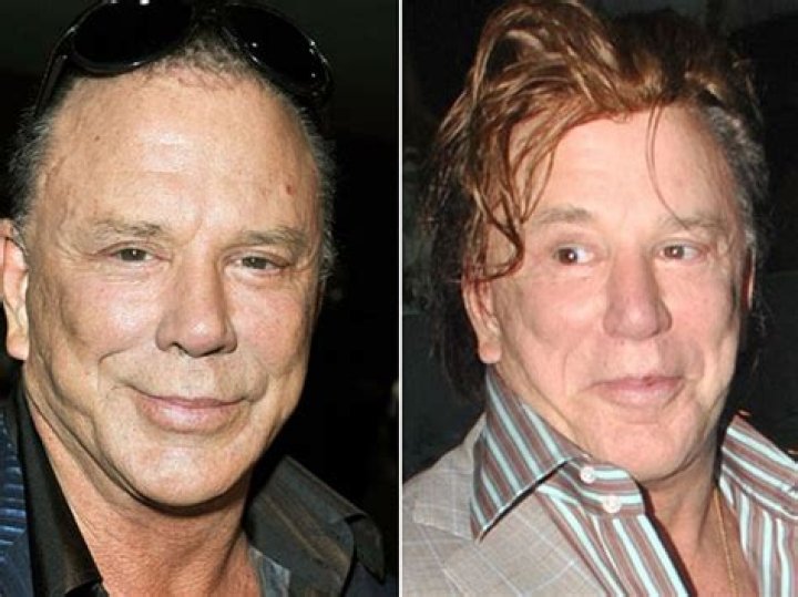 What Happened To Mickey Rourke’s Face?